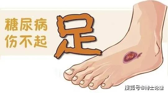 糖尿病早期症状与养生缓解之道